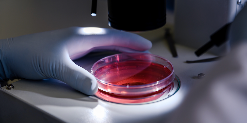 Researcher examining a cell culture dish under a microscope in a laboratory